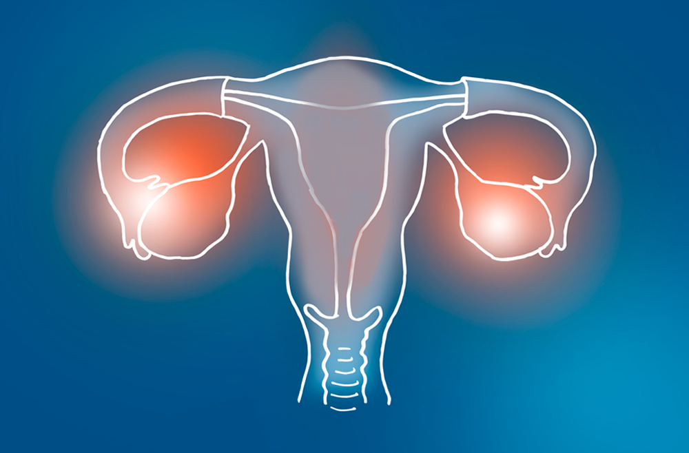 A digital illustration of a uterus diagram